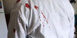 اعتداء على الأطباء.png